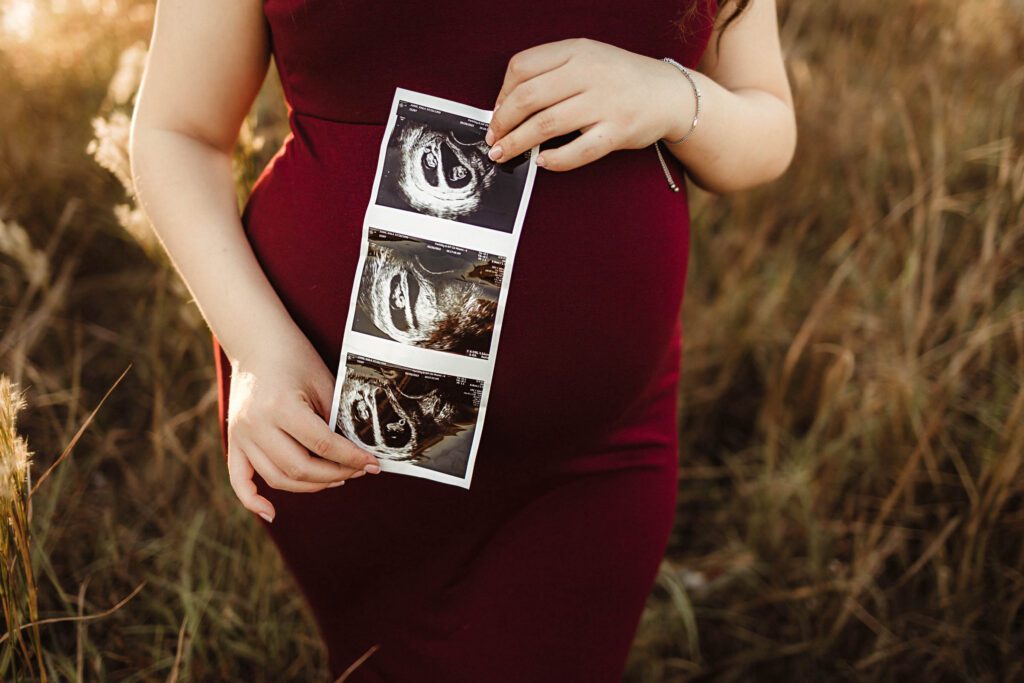expectant mom holding sonogram photo